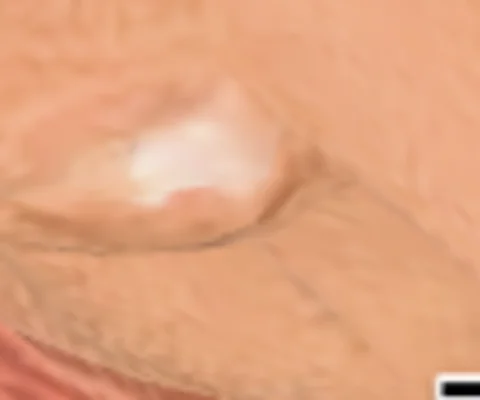 A small unwanted white patch on a figurine’s nose before touch-up